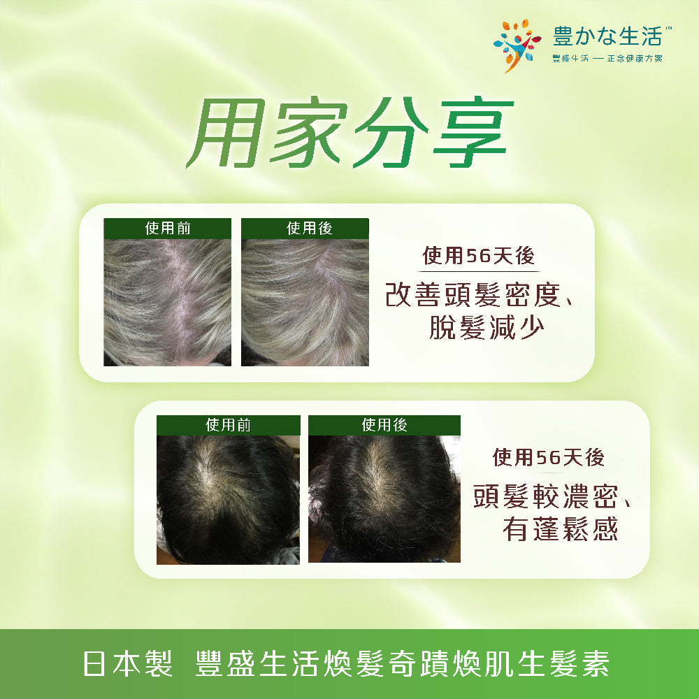 用家見證 頭髮密度改善、脫髮情況減少